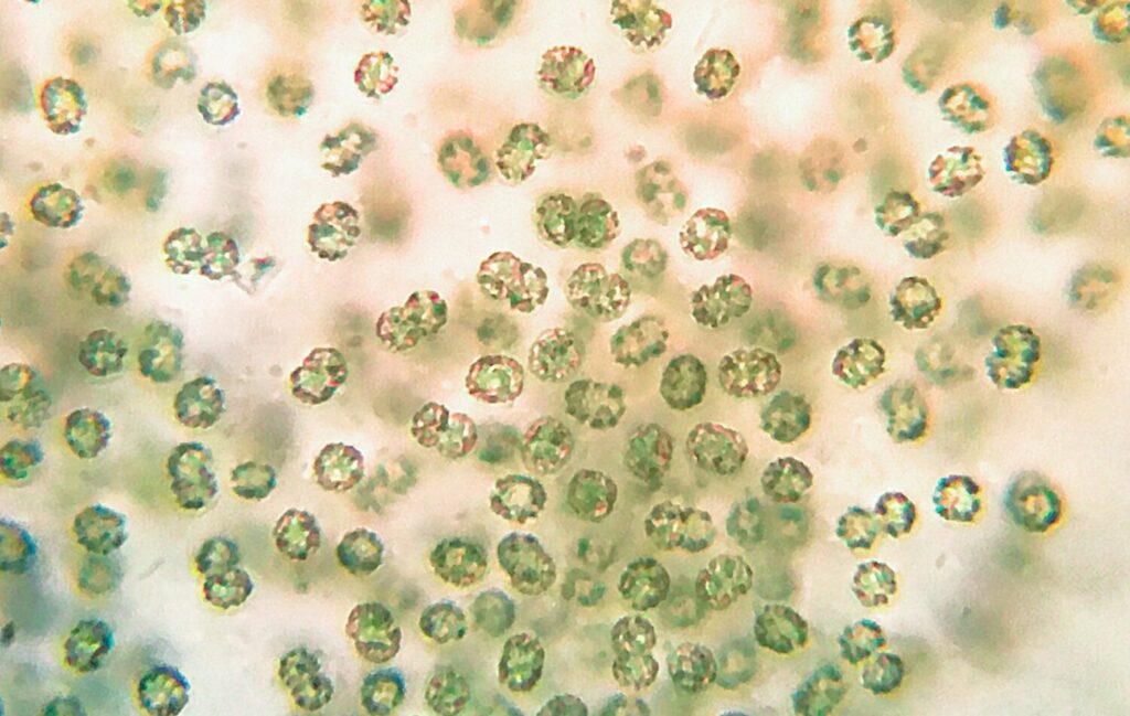 Immagine al microscopio di cianobatteri Microcystis 1