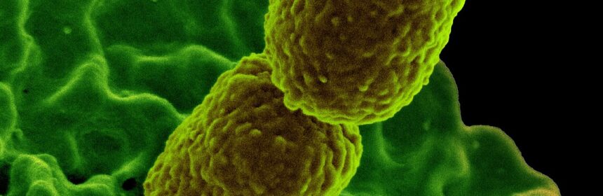 Klebsiella pneumonia Bacterium 13383560994